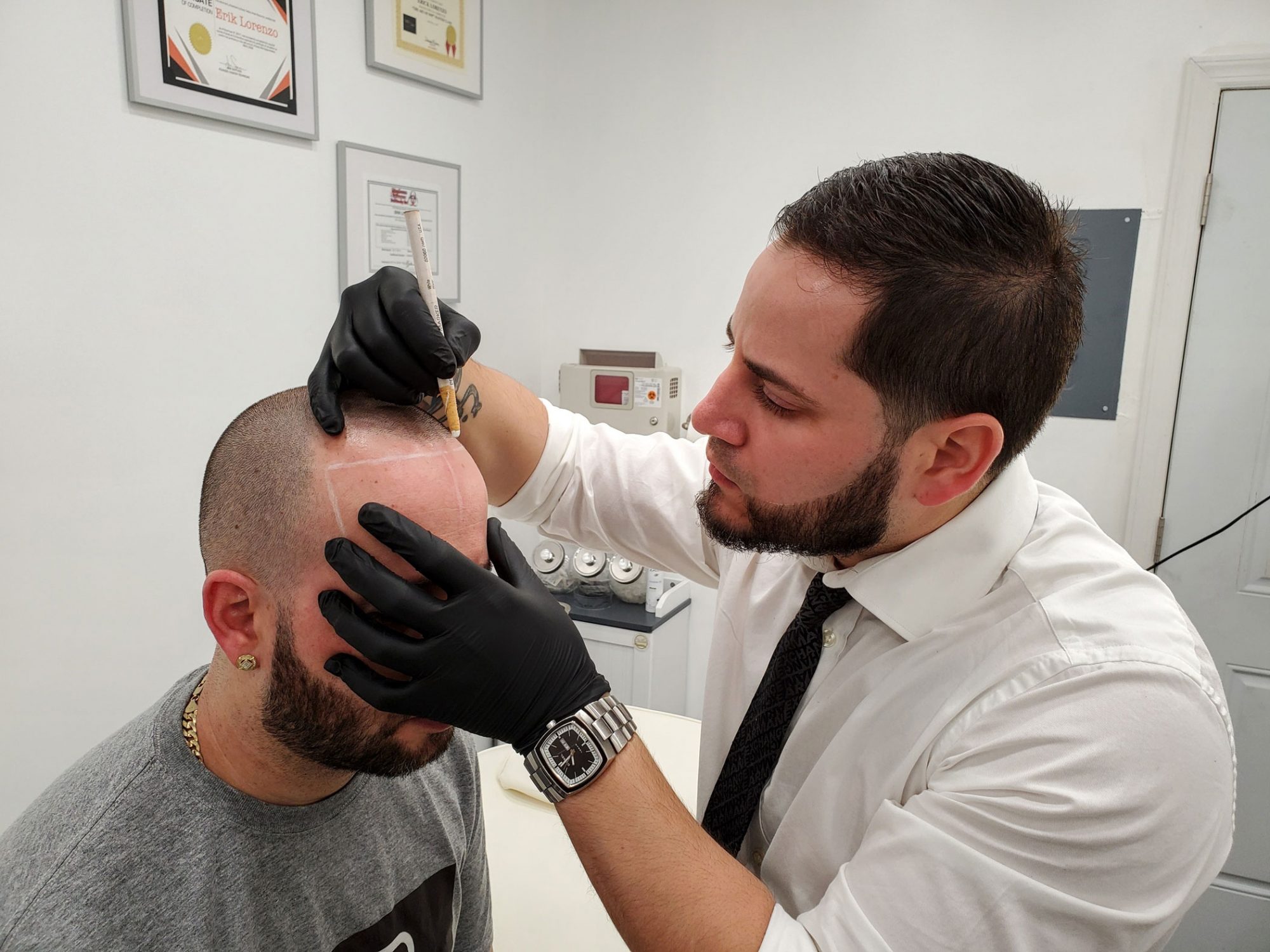 Erik Lorenzo, founder of Artisan Scalp Micropigmentation, mapping a client's hairline before treatment